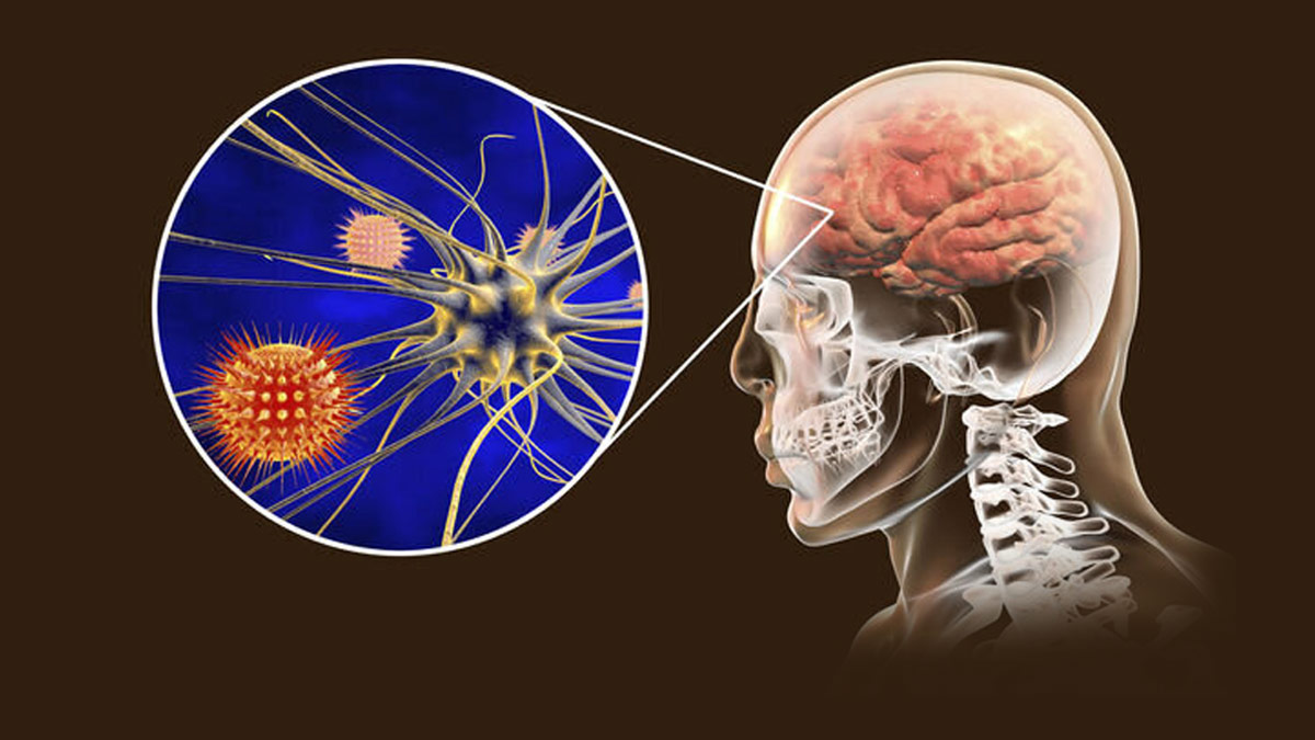 How Does Corona Virus Affect the Brain?